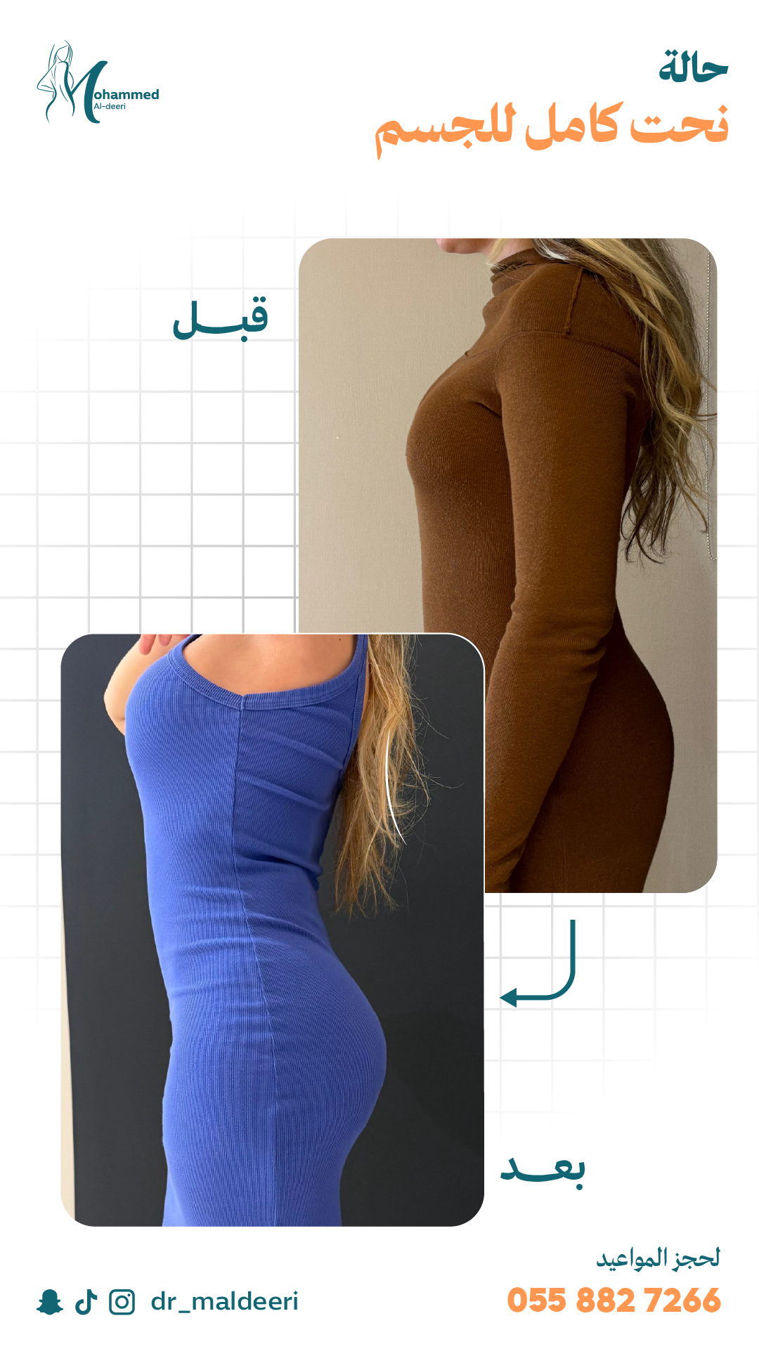 نتائج العملية