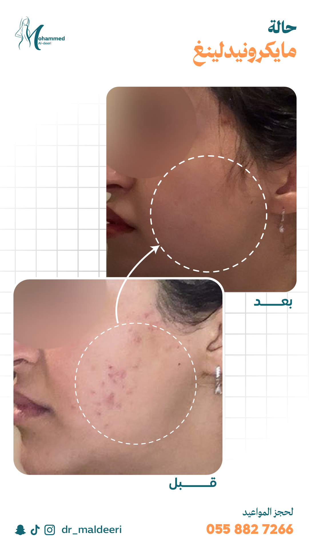 نتائج العملية