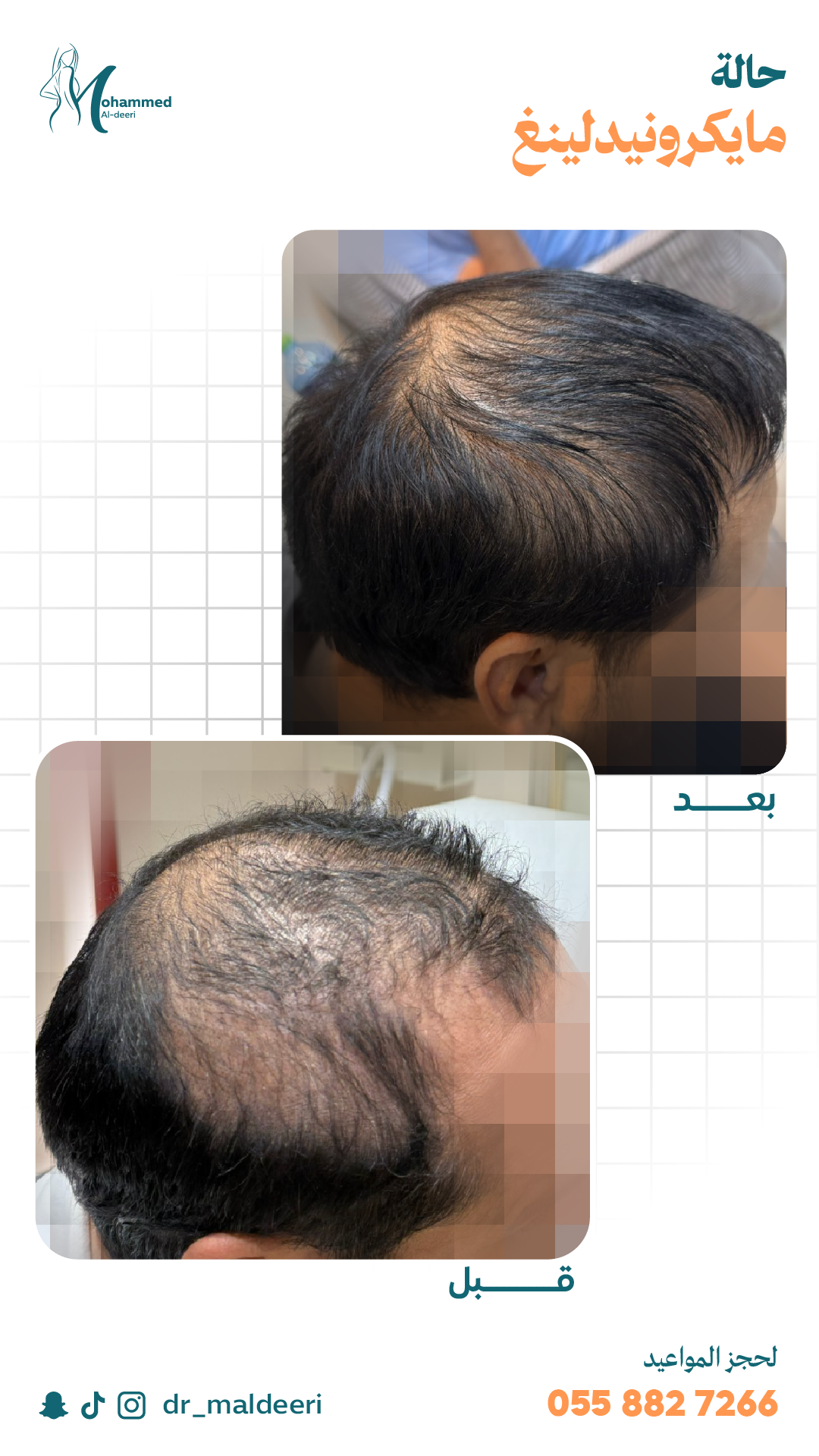 نتائج العملية