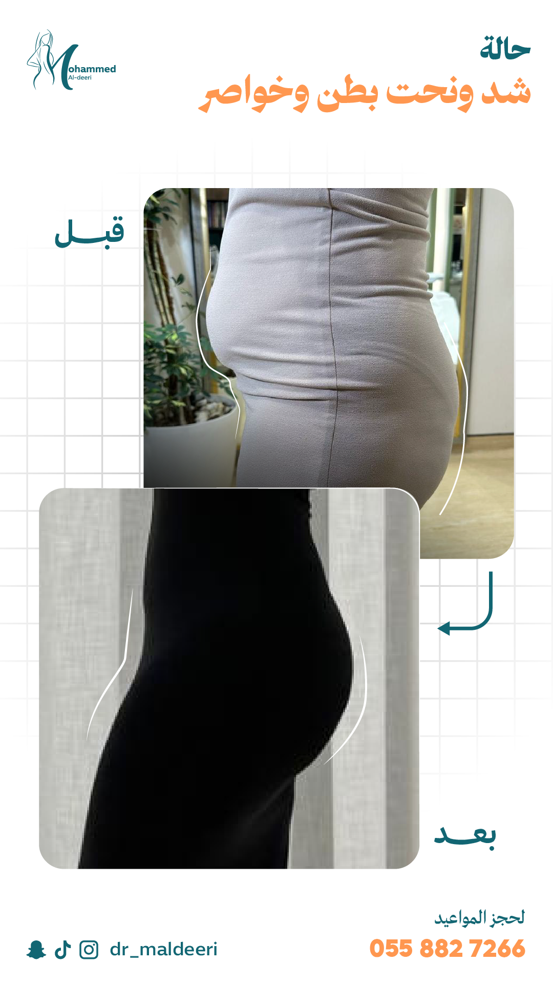 نتائج العملية