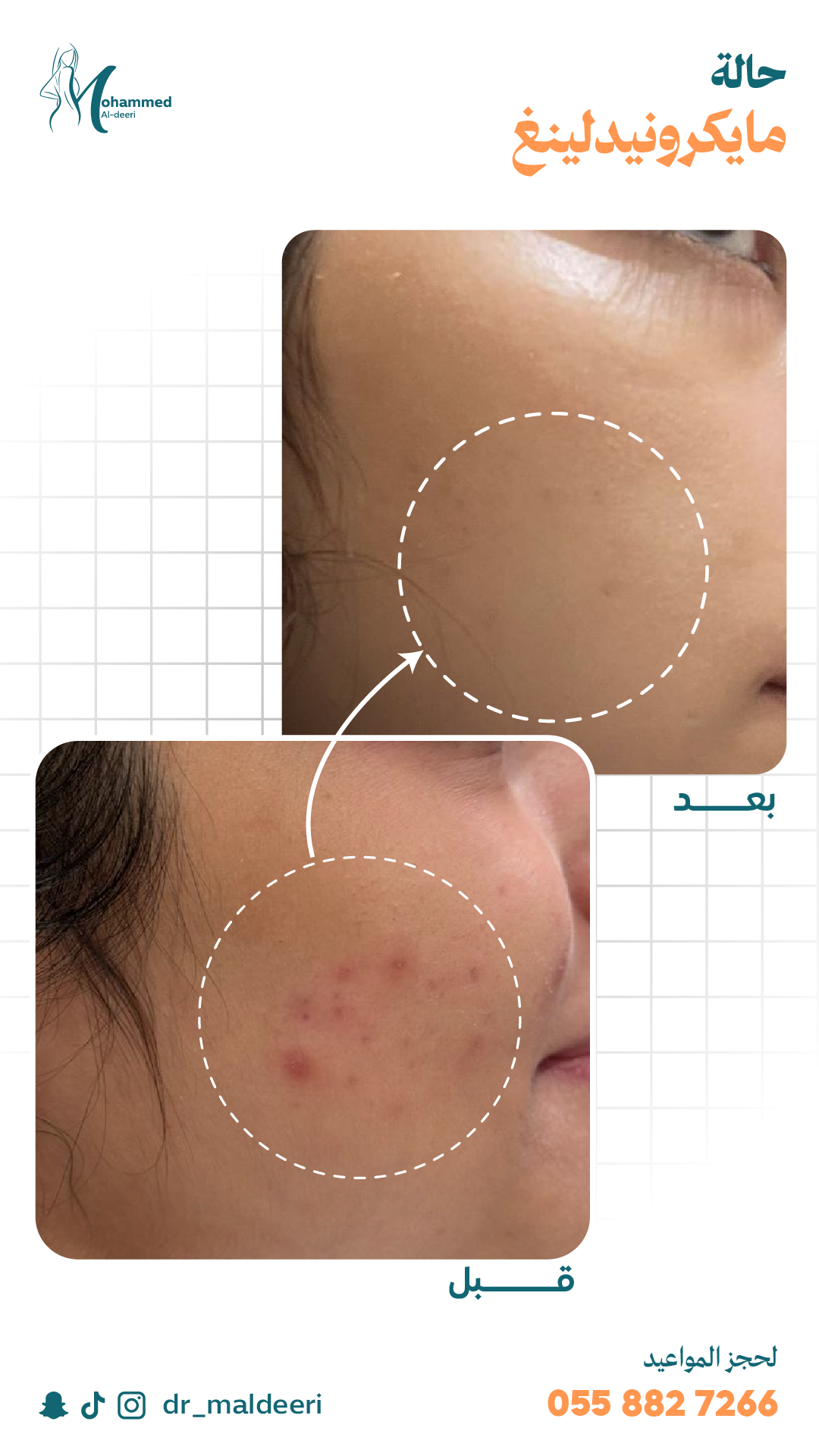 نتائج العملية