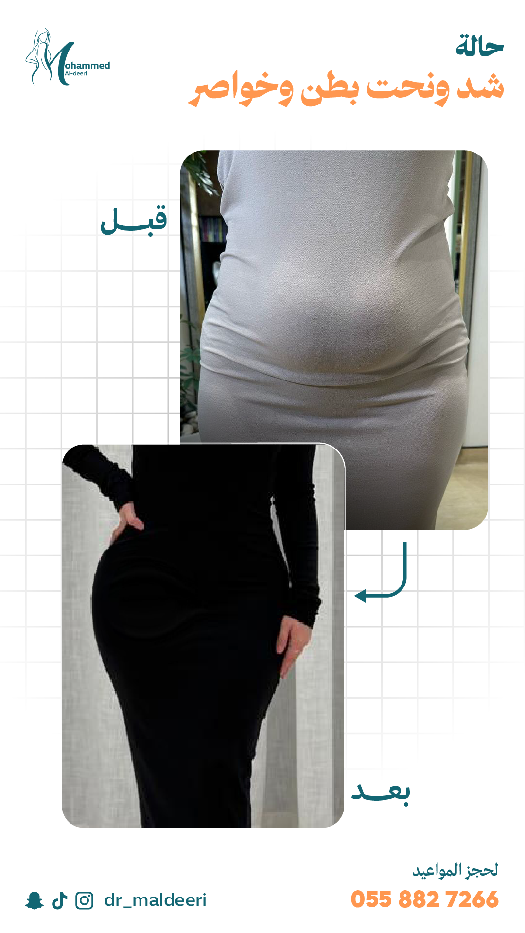 نتائج العملية