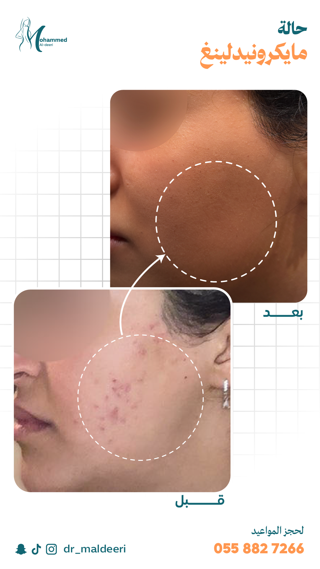 نتائج العملية