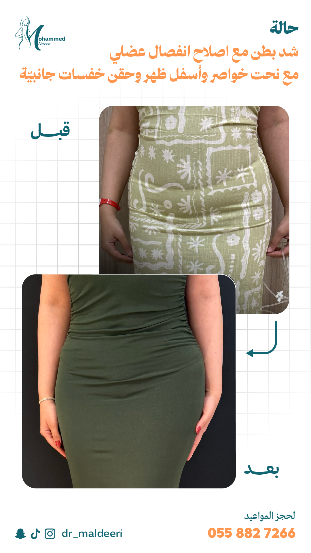 نتائج العملية
