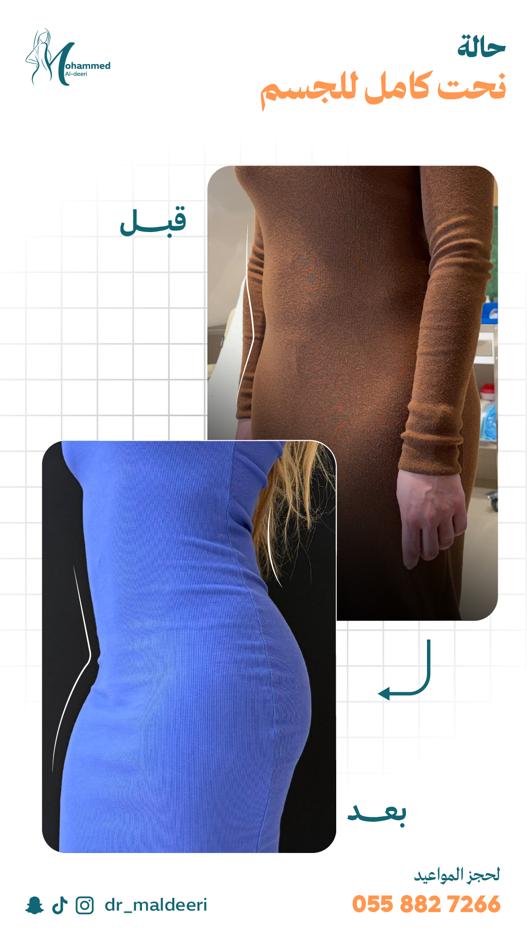 نتائج العملية
