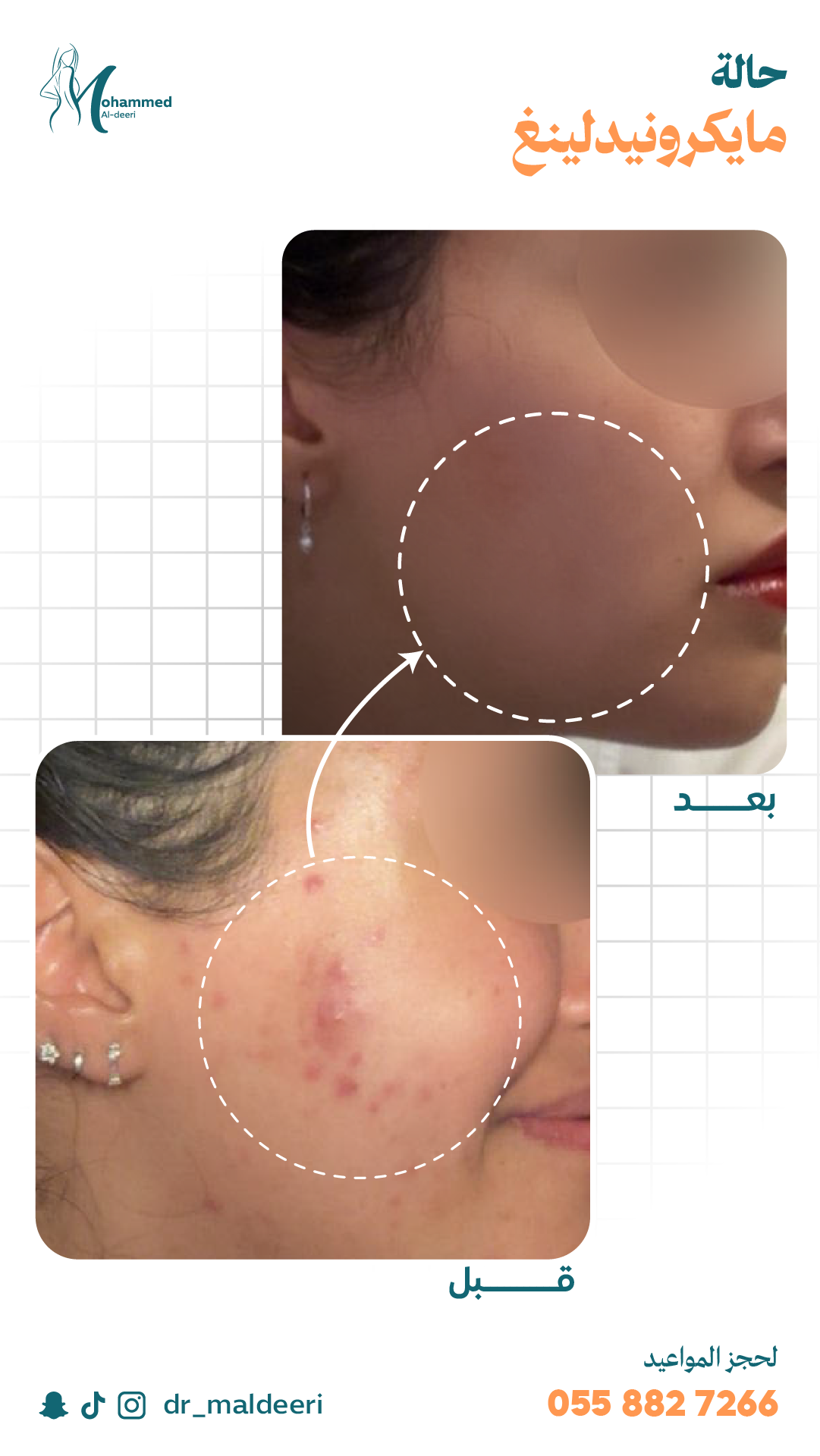 نتائج العملية