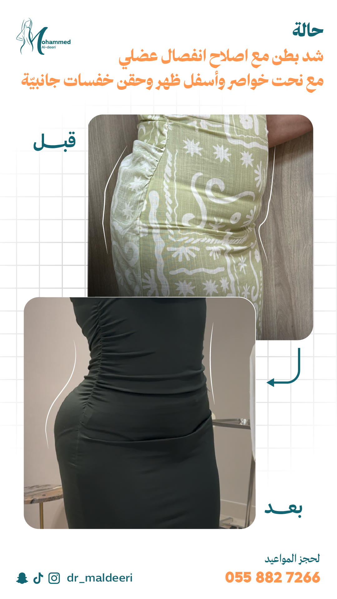 نتائج العملية
