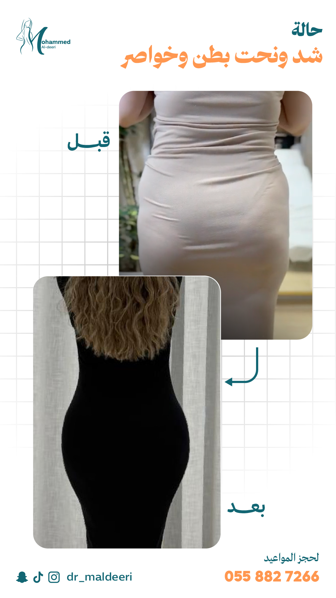 نتائج العملية